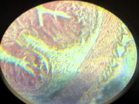 ascaris  sp. .jpg